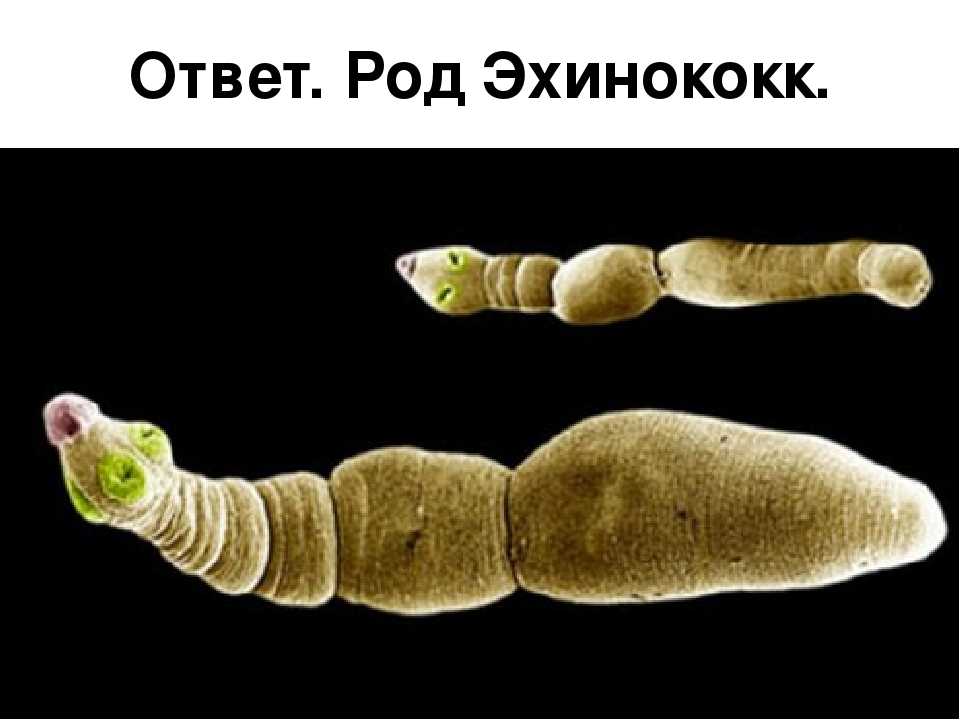 Эхинококкоз: симптомы у человека, лечение, анализы, диагностика | азбука здоровья