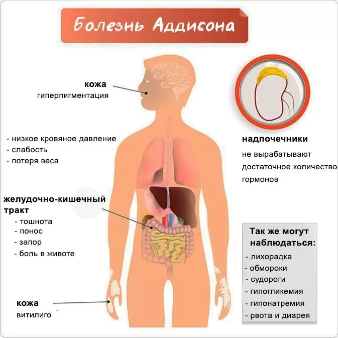 Болезнь аддисона - подробный обзор заболевания у собак | ваши питомцы