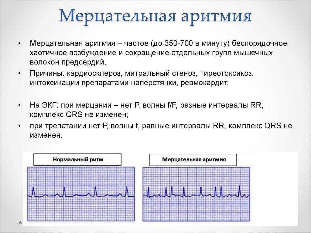Сердечная аритмия у собак, причины, диагностика и лечение | блог ветклиники "беланта"