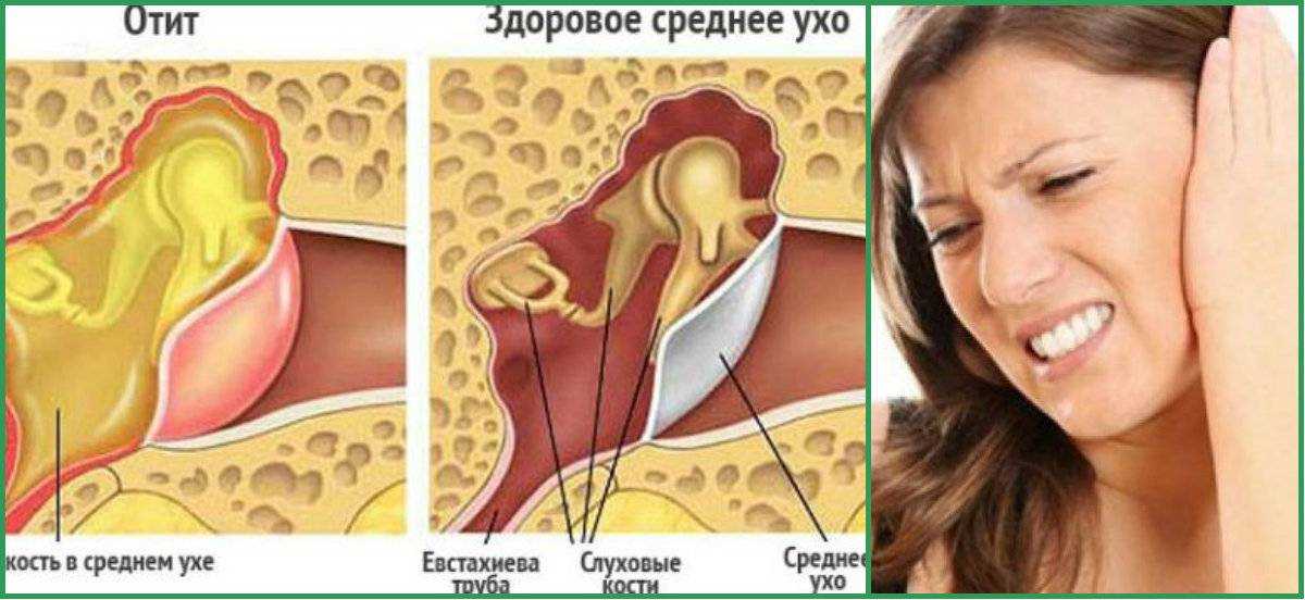 Гнойный отит у кошек: классификация, причины, симптомы, лечение | звери дома
