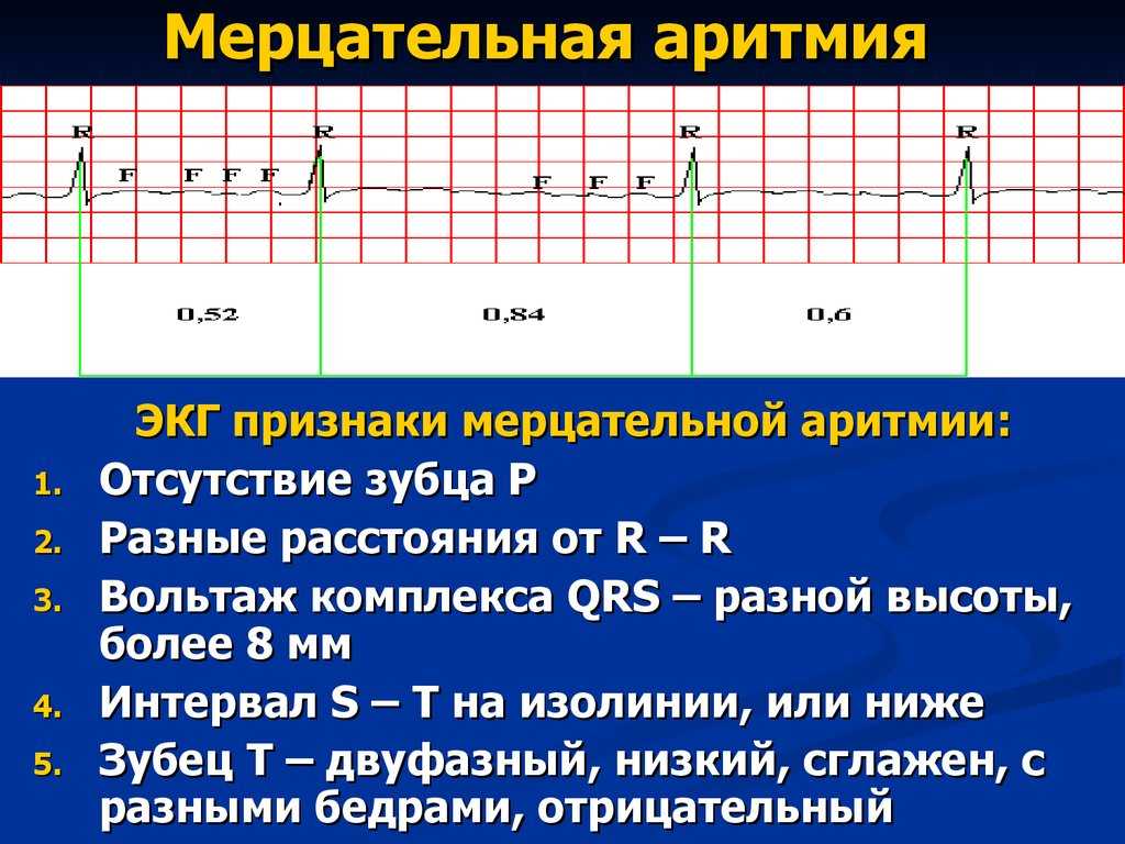 Сердечная аритмия у собак, её причины, диагностика и лечение