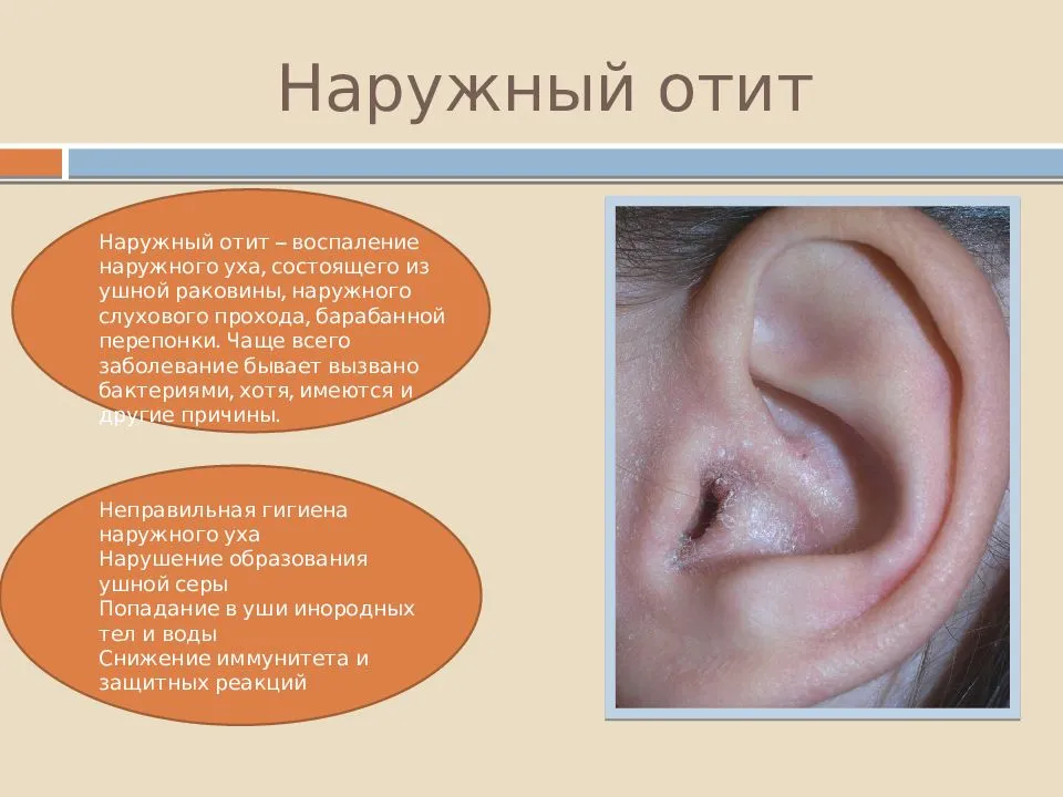 У собаки запах из ушей