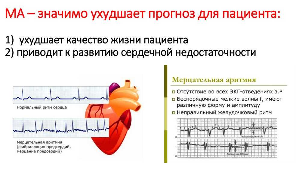 Приступ острой сердечной недостаточности у собаки