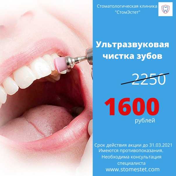 Чистка зубного камня у собак