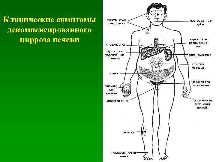 Болезни печени. болезни собак (незаразные)