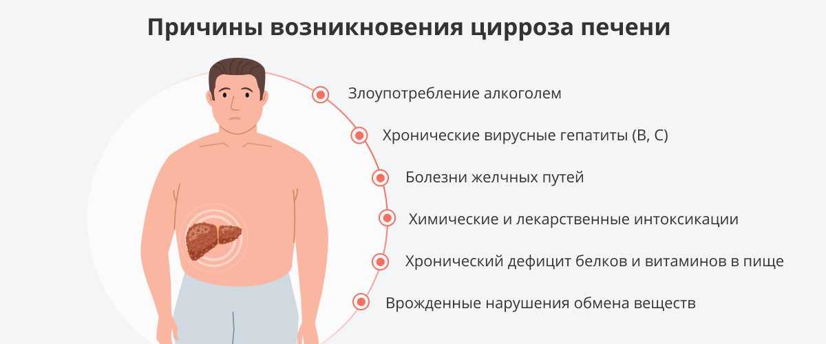 Диагноз «цирроз печени» - что нужно знать и делать?