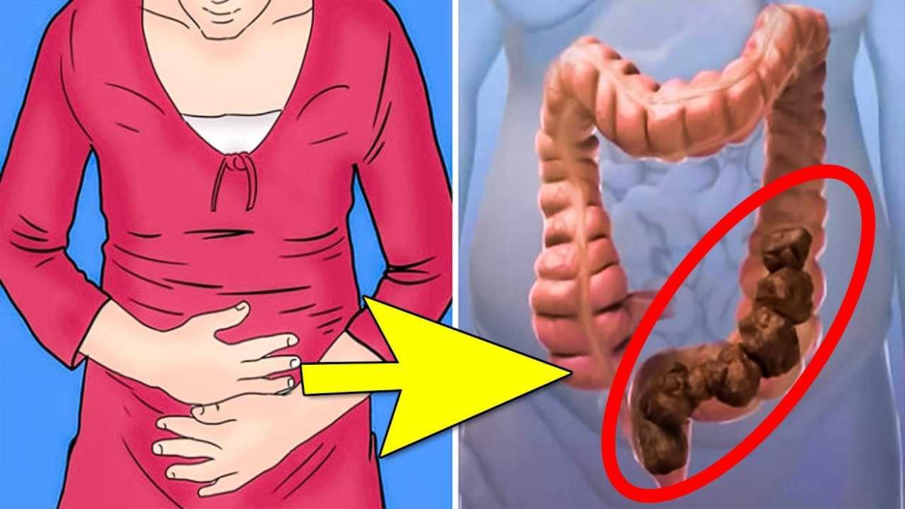 Лечение асцита у кошек