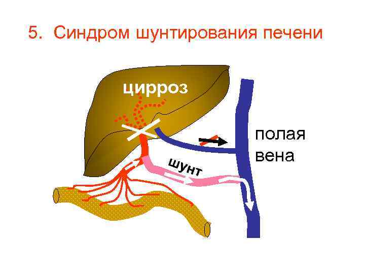 Домашняя диета для собак при печеночном шунте - собаки 2023