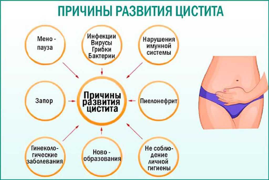 Цистит у кошек: симптомы, диагностика, лечение, профилактика | блог ветклиники "беланта"