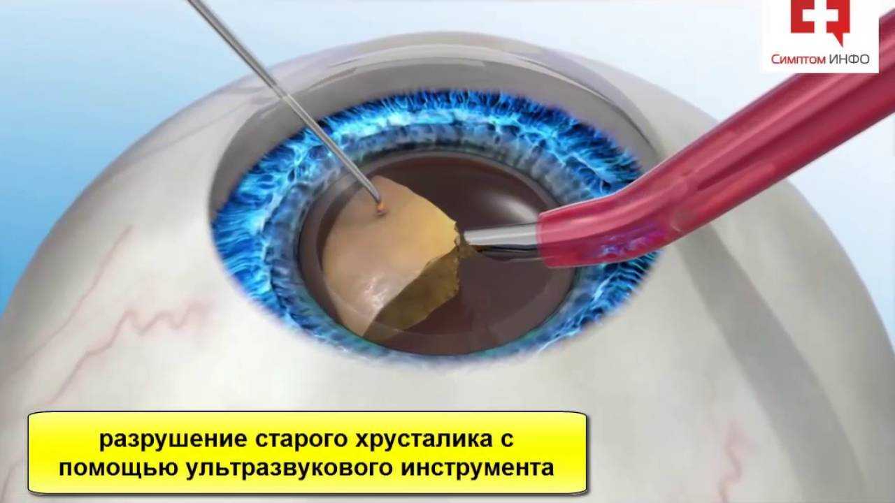 Катаракта у кошек, котов и собак: лечение и симптомы | фото